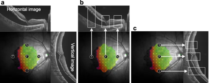 Figure 6.  Analysis of retinal structures at the measurement points of retinal sensitivity