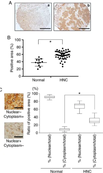 Figure 1. Expression of HMGB1 in HNC and head and neck normal tissues. 