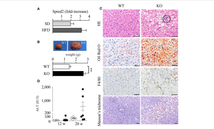 FIGURE 5 | Exacerbated fatty liver disease in Spred2 KO mice. (A) WT mice were fed with either SD or HFD (6 mice each group) from 4 to 20 weeks of age
