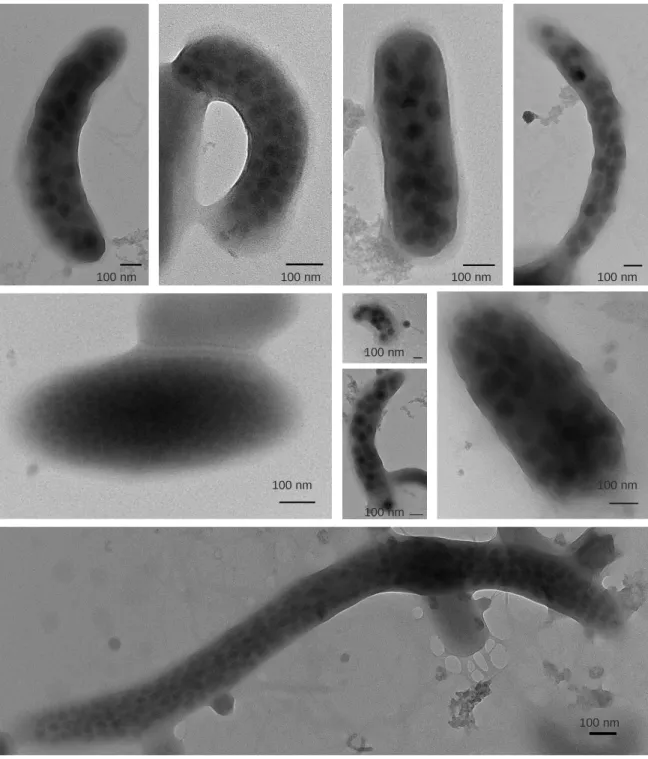 Figure 3.8  Transmission electron micrographs (TEM) of bacterial cells infected by viruses