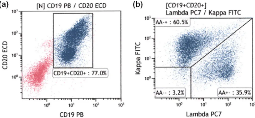 Fig. 3. Flow cytometric  results for rectal lymphoid hyperplasia. (a) CD19  +  /CD20  + cells were gated; (b) Light chain  expression  was analyzed and the  κ /  λ ratio was found to be 1.69 (normal range), indicating that the sample was negative for light