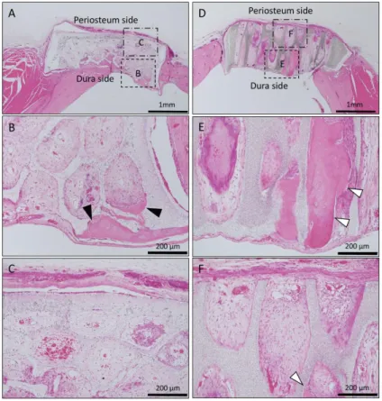 Figure 4. Analysis of bone formation on honeycomb β-TCP in micro CT image in Collagen gel group at 4 weeks after implantation