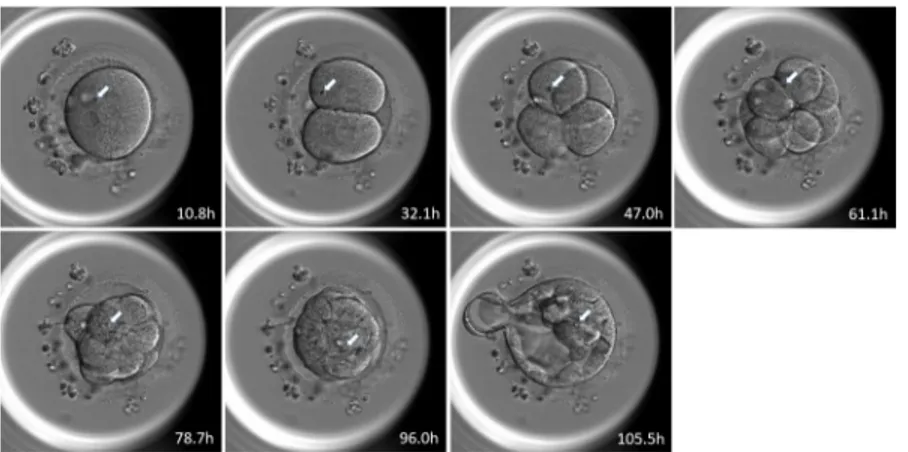 Fig 3. Example of blastomere distribution to the ICM or TE obtained by tracking the position of refractile bodies.