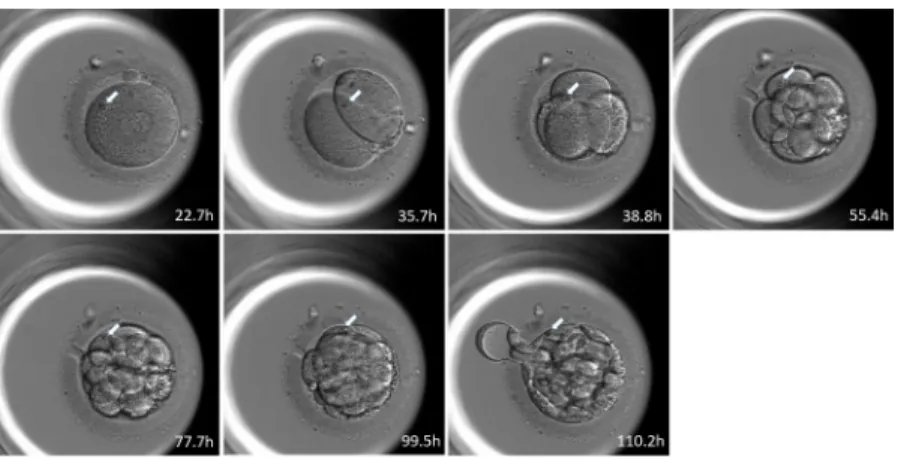 Fig 4. Example of blastomere distribution to the ICM or TE obtained by tracking the position of refractile bodies.