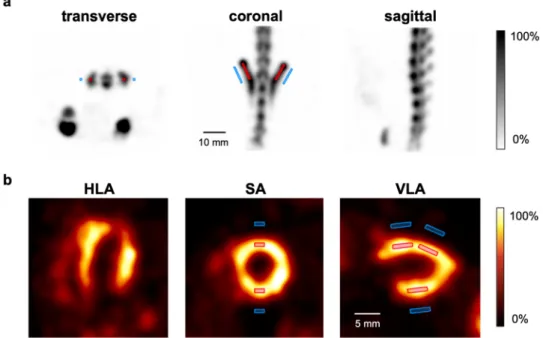 Figure 2.  In vivo contrast-to-noise ratio method. (a)   [ 99m Tc]Tc-HMDP SPECT image of the lower spine  and pelvis region of a healthy rat from transverse, coronal and sagittal perspective