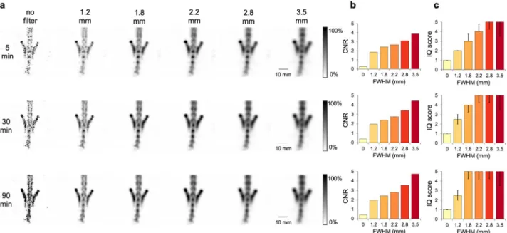 Figure 6b depicts results of the in vivo CNR analysis. Irrespective of acquisition time, Gaussian filtering of  3.5 mm was associated with the highest CNR values