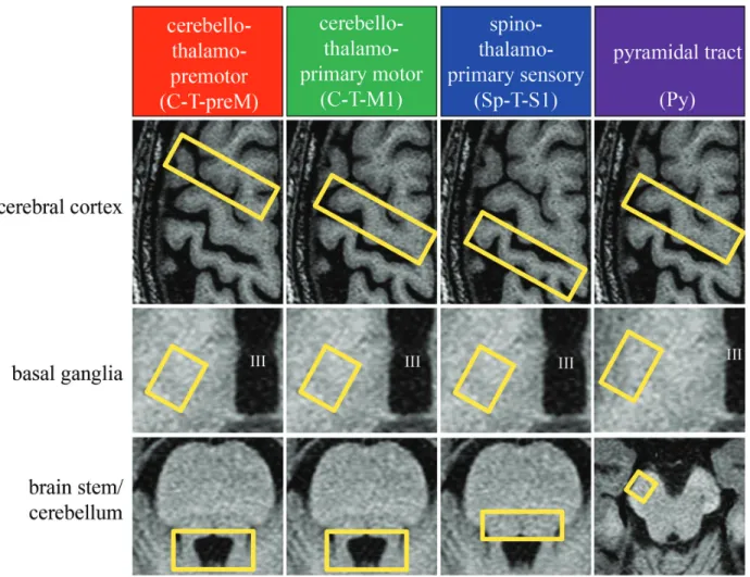 Fig. 1  Four fiber tracts evaluated in this study. Four fiber tracts are described by setting three VOIs