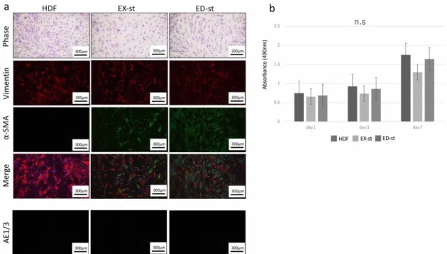 Figure 1. Generation of tumor stroma from human oral squamous cell carcinoma (OSCC). (a) Isolated  tumor stroma had irregular spindle-shaped morphology, whereas dermoid fibroblasts (HDF)s had  regular short spindle-shaped morphology