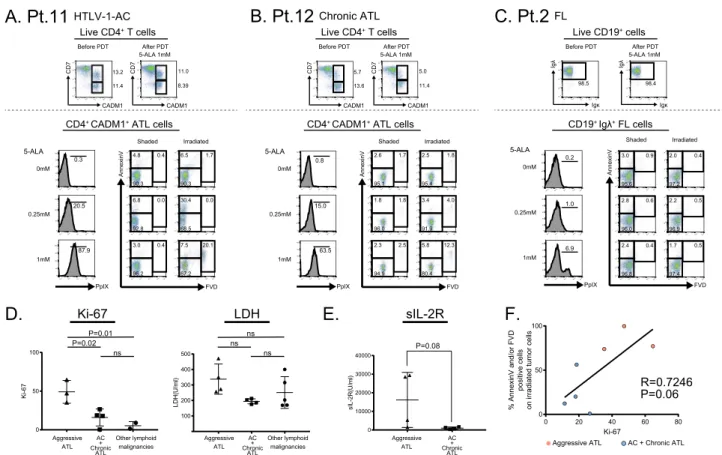 Figure 2.  The effect of PDT on indolent lymphoid malignancies was limited in case PpIX accumulation was  not sufficient
