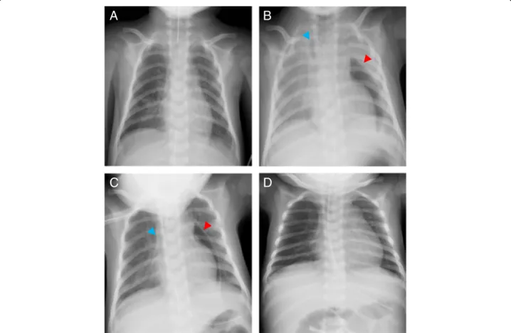 Fig. 1 Chest X-rays in the operating room and in the intensive care unit. a Right after the pericardiocentesis, b before re-intubation