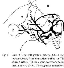 Fig.  1•@ Case  1.  Dissected  arterial  system  in  human 