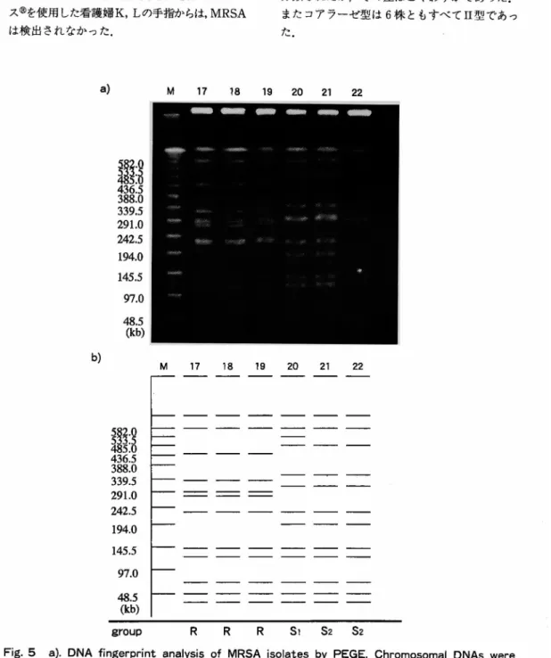 Fig.  5  a).  DNA fingerprint  analysis  of  MRSA  isolates  by  PEGE.  Chromosomal  DNAs  were   digested  with  Sma  I restriction  enzyme
