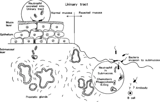 Fig.  14  Local  Immunity  after  Transurethral  Resection  of  Prostate