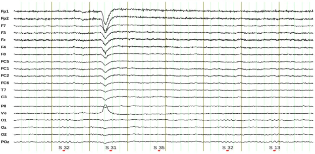 Figure 1.3 Schematic of the ERP data 
