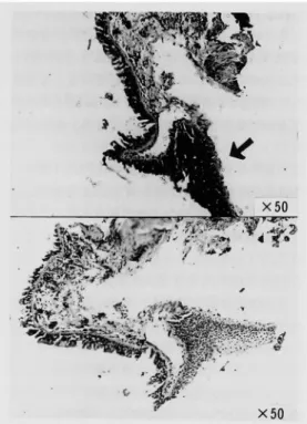Fig.  6  Immunohistochemical  staining  of  case  4