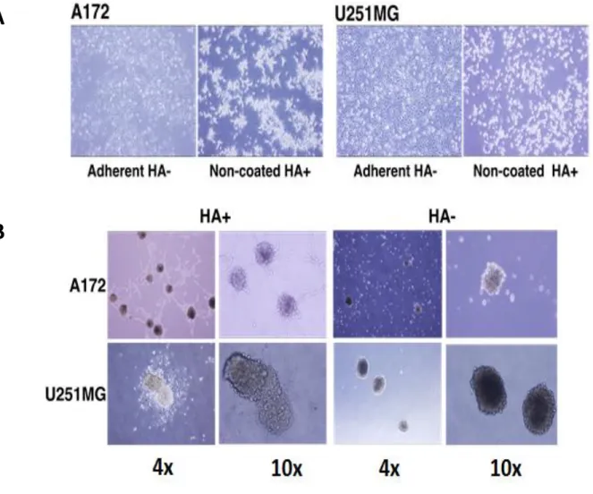 Figure 2: Induction of A172 and U251MG cells with HA. A) Cell morphology of A172  and U251MG cells on adherent and non-coated dish