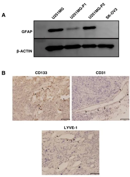 Figure 9  : Characterization of the tumor in  the  mouse. (A) To  check the extent of the  differentiation in the tumor we compared the GFAP by western blotting in the parental,  primary  and  secondary  tumor  culture  in  vitro