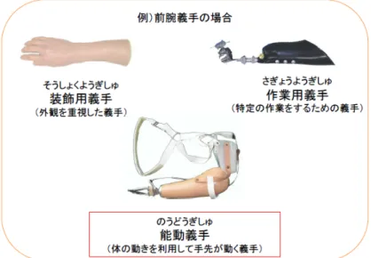 Fig. 1.2: About type of prosthetic hand  2 [2]