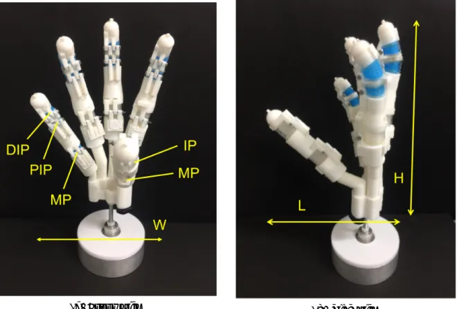 Fig. 2.1: Pneumatic myoelectric prosthetic hand