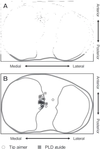 Table 2　 Tibial tunnel positions in the Tip aimer and PLD guide  groups