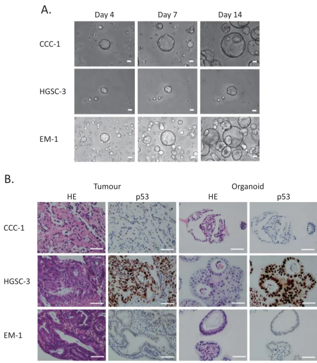 Figure 1.  Patient-derived primary ovarian cancer organoids maintain the histological architecture and  p53 positivity of the tumour subtype from which they are derived