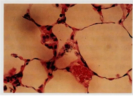 Fig.  8  Time  course  of  radioactive  ascaris  and 