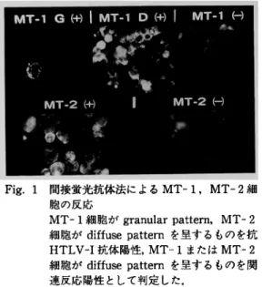 Fig.  1  間 接 蛍 光 抗 体 法 に よ るMT‑1,  MT‑2細 胞 の 反 応 MT‑1細 胞 がgranular  pattern,  MT‑2 細 胞 がdiffuse  patternを 呈 す る も の を 抗 HTLV‑I抗 体 陽 性,  MT‑1ま た はMT‑2 細 胞 がdiffuse  patternを 呈 す る も の を 関 連 反 応 陽 性 と し て 判 定 し た