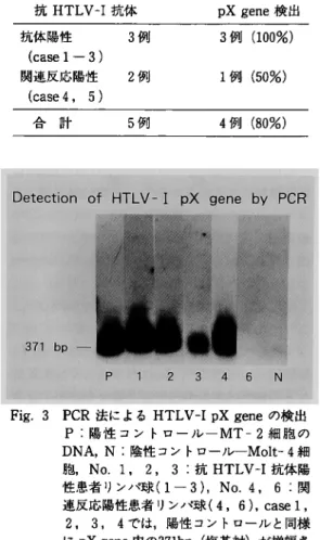Table  4  抗HTLV‑I抗 体 とpX  geneの 検 出