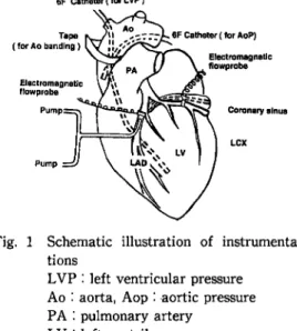 Fig.  1  Schematic  illustration  of  instrumenta tions