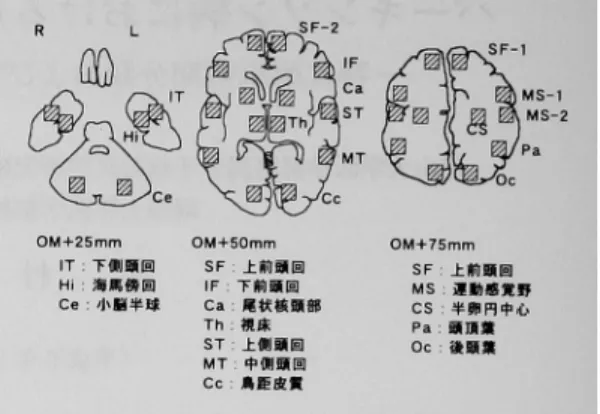Fig.  2  Regions  of  interest  (ROI)