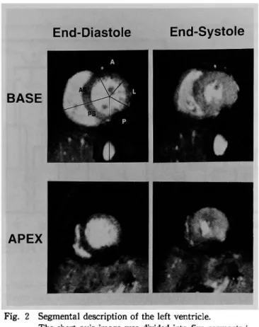 Fig. 2  Segmental  description of the left  ventricle.