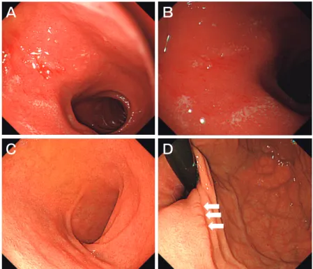 Fig. 2　 Endoscopy  images  of  Patient  1.  
