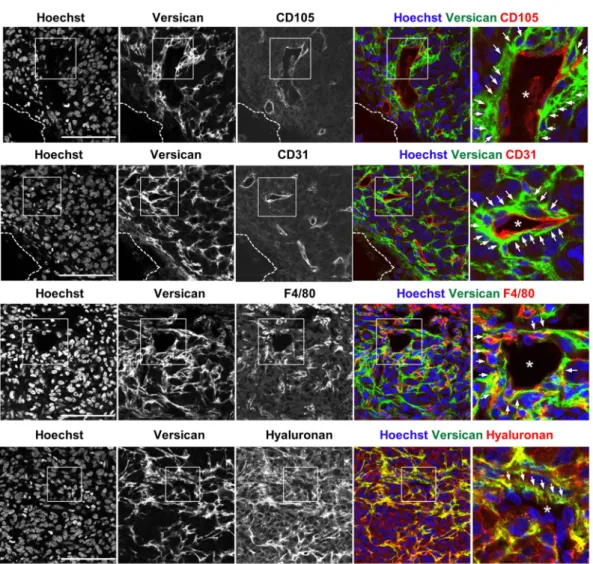 Figure 2.  Localization of versican GAG β in the vicinity of MDA-MB231 tumor vasculature