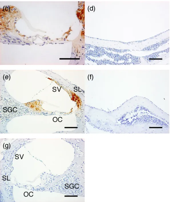 Figure 3: Immunohistochemical staining for macrophage migration inhibitory factor 