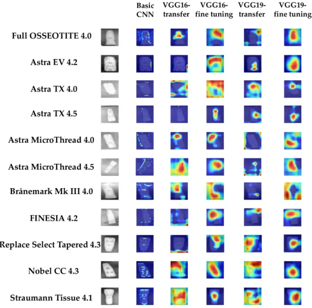 Figure 4 shows images of the 11 types of dental implants classified using each CNN model, visualized using Grad-CAM