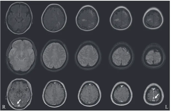 Fig. 1 MRI on Day 8.