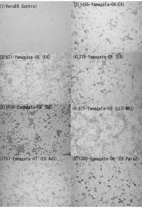 図  ヒトメタニューモウイルス等の細胞変性効果写真  (1)Vero E6 細胞コントロール，(2)(3)Vero  E6 細胞におけるヒトメタニューモウイルスの細胞変性効果，(4)(5)Vero E6 細胞におけるヒトメ タニューモウイルスの細胞変性効果（合胞体形成），(6)LLC-MK2 細胞におけるヒトメタニュー モウイルスの細胞変性効果，(7) Vero E6 細胞におけるアデノウイルス 3 型の細胞変性効果，(8)  Vero E6 細胞におけるパラインフルエンザウイルス 2 型の細胞変性効果（合