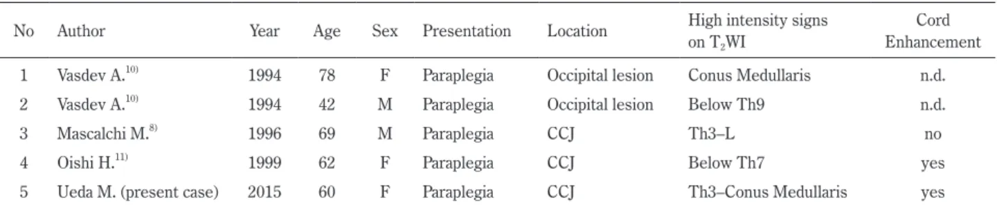 Table 1  Summary of cases of intracranial DAVF with thoracolumbar myelopathy. No Author Year Age Sex Presentation Location High intensity signs  