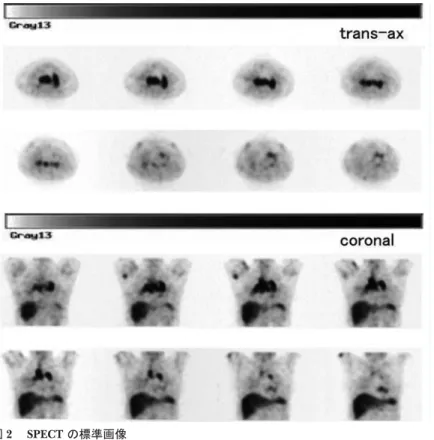 図 3 全身 SPECT coronal image の標準画像