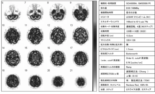 図 3 基準画像と収集条件（ 3 検出器 99m Tc 製剤）〈カラー掲載参照〉