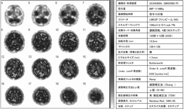 図 4 基準画像と収集条件（ 3 検出器 123 I 製剤）〈カラー掲載参照〉