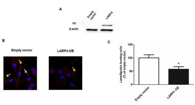 Figure 3. LARP4 overexpression decrease lamellipodia formation in SKOV3 cells  (A) Protein expression demonstrated by western blot showing LARP4 overexpression  effect of LARP4 vector