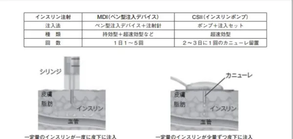 図 4  MDI, CSII の比較 38)