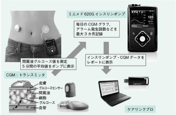 図 5  SAP 療法 38