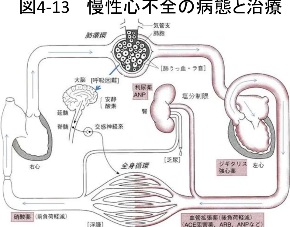 図 4-13    慢性心不全の病態と治療