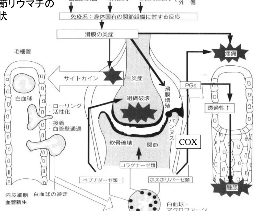 図 14-3 関節リウマチの 病因と症状