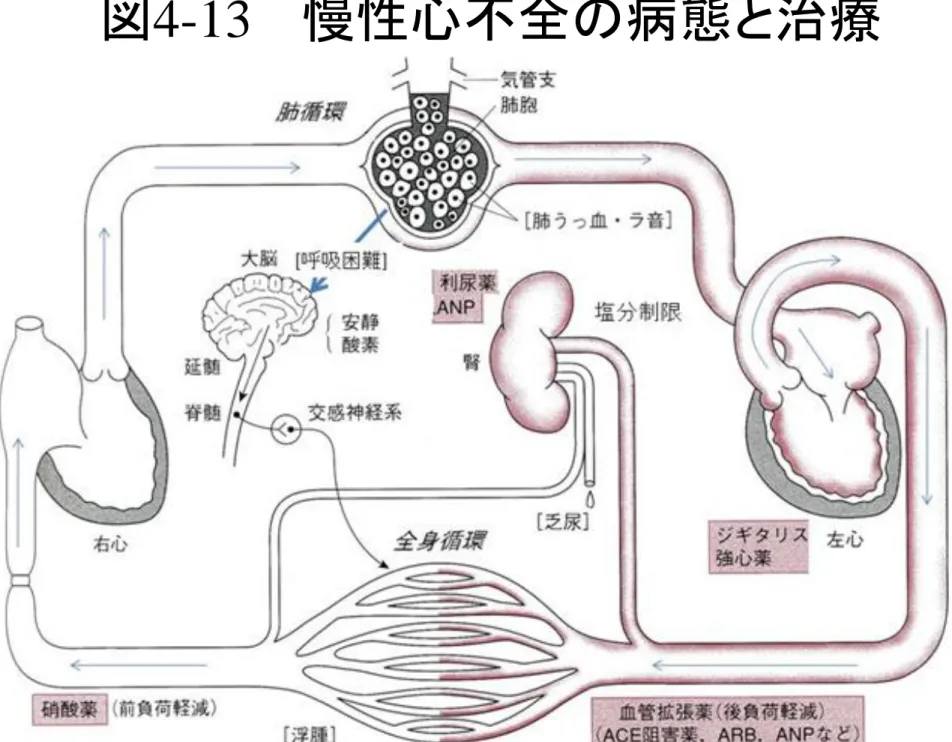 図 4-13  慢性心不全の病態と治療