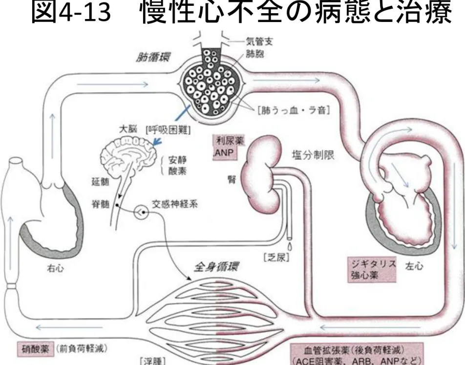図 4-13  慢性心不全の病態と治療