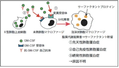 図 1. 肺胞蛋白症