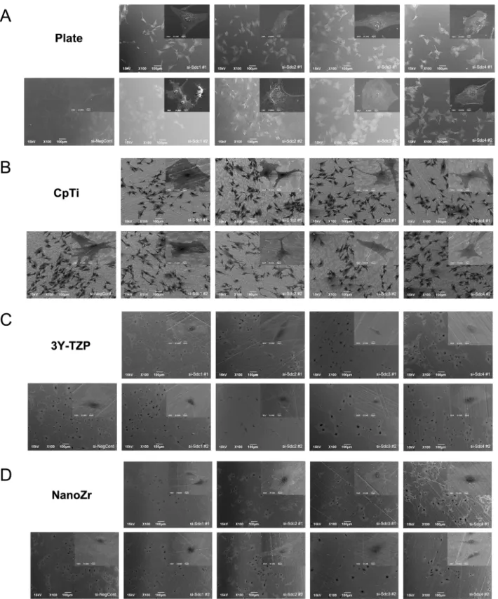 Figure  2.  SEM  observation  of  cell  morphology  of  MC3T3-E1  cells  cultured  on  different  surfaces after 48h RNA interference treatment